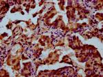 POU5F1B Antibody in Immunohistochemistry (Paraffin) (IHC (P))