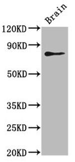 SKIB Antibody in Western Blot (WB)