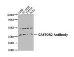 GATSL2 Antibody in Western Blot (WB)