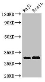 HLA-DRB3 Antibody in Western Blot (WB)