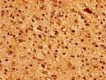 HLA-ABC Antibody in Immunohistochemistry (Paraffin) (IHC (P))