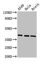 HLA-ABC Antibody in Western Blot (WB)