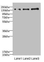 NRXN1 Polyclonal Antibody