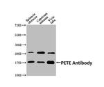 PETE Polyclonal Antibody