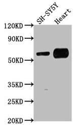 JRK Polyclonal Antibody