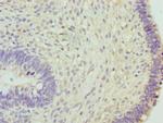 HCE Polyclonal Antibody