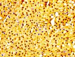 RMP Antibody in Immunohistochemistry (Paraffin) (IHC (P))