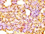 RMP Antibody in Immunohistochemistry (Paraffin) (IHC (P))