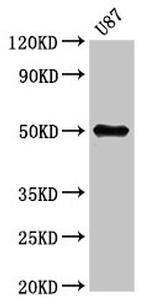 RMP Antibody in Western Blot (WB)