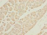 GALNT2 Polyclonal Antibody
