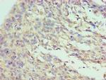 ILF3 Polyclonal Antibody