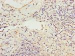 RBMS2 Antibody in Immunohistochemistry (Paraffin) (IHC (P))