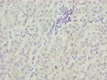 TAF5 Polyclonal Antibody