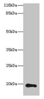 RAB30 Antibody in Western Blot (WB)