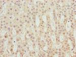 TBCE Polyclonal Antibody