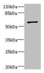 TBCE Antibody in Western Blot (WB)
