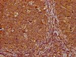 RABEP1 Polyclonal Antibody
