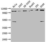 RABEP1 Antibody in Western Blot (WB)