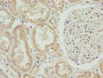 HADH Polyclonal Antibody
