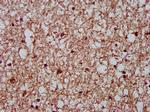 CKAP5 Antibody in Immunohistochemistry (Paraffin) (IHC (P))