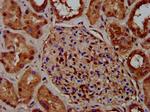 CKAP5 Antibody in Immunohistochemistry (Paraffin) (IHC (P))