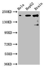 CKAP5 Antibody in Western Blot (WB)