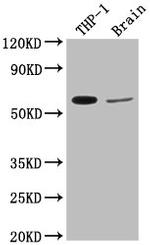 COL9A2 Polyclonal Antibody