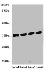 CARP Antibody in Western Blot (WB)