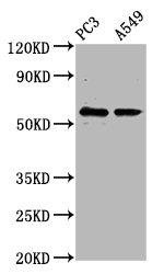 CYP1B1 Polyclonal Antibody
