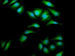 EMAP II Polyclonal Antibody