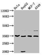 EMAP II Antibody in Western Blot (WB)