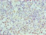 hnRNP D Polyclonal Antibody