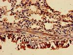 ASC1 Antibody in Immunohistochemistry (Paraffin) (IHC (P))