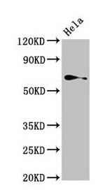 ASC1 Antibody in Western Blot (WB)