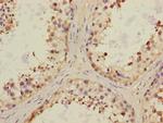 CHRNA6 Polyclonal Antibody