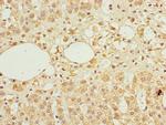 TFCP2 Polyclonal Antibody