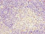 TFCP2 Antibody in Immunohistochemistry (Paraffin) (IHC (P))
