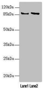 JIP2 Polyclonal Antibody