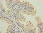 Cytokeratin 33B Antibody in Immunohistochemistry (Paraffin) (IHC (P))