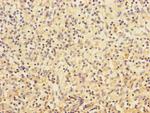 CHRNA2 Antibody in Immunohistochemistry (Paraffin) (IHC (P))
