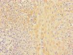 CHRNA2 Polyclonal Antibody
