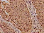 KPNB1 Polyclonal Antibody