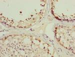 TOMM34 Antibody in Immunohistochemistry (Paraffin) (IHC (P))