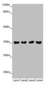 TOMM34 Antibody in Western Blot (WB)