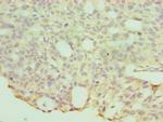 HYAL1 Polyclonal Antibody