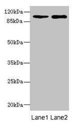 GluR7 Antibody in Western Blot (WB)