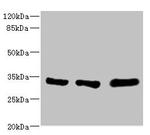 eIF2b alpha Antibody in Western Blot (WB)