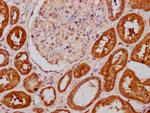 PLS1 Antibody in Immunohistochemistry (Paraffin) (IHC (P))