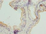 TPD52L1 Antibody in Immunohistochemistry (Paraffin) (IHC (P))