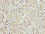TPD52L1 Polyclonal Antibody